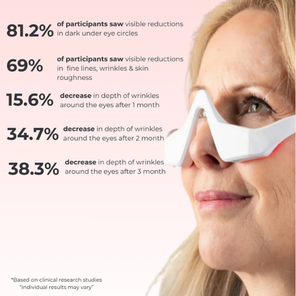 YFY-Red Light Therapy Eye Massager